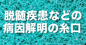 中枢神経系のミエリン形成に必須の分子を発見－脱髄疾患などの病因解明の糸口に－