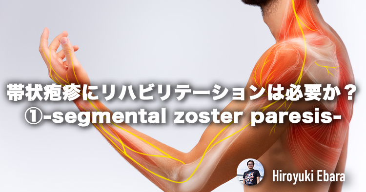 帯状疱疹にリハビリテーションは必要か？①-segmental zoster paresis-