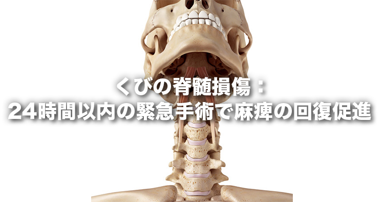 くびの脊髄損傷：24時間以内の緊急⼿術で⿇痺の回復促進