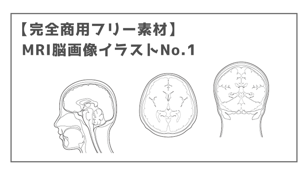 【完全商用フリー素材】MRI脳画像イラストNo.1ー矢状面、水平面、前額面ー