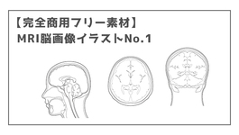 【完全商用フリー素材】MRI脳画像イラストNo.1ー矢状面、水平面、前額面ー
