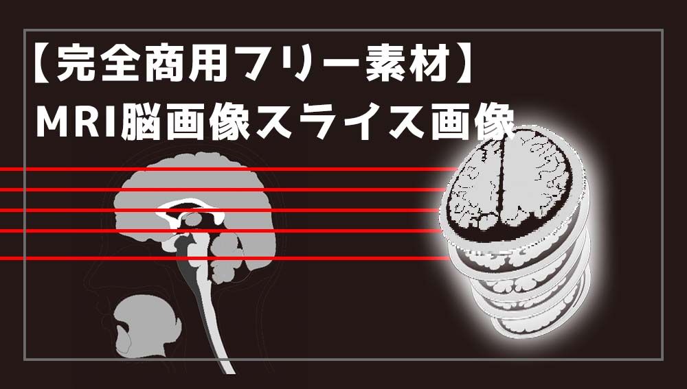 【完全商用フリー素材】MRI脳画像｜スライス画像（中心溝、側脳室、基底核、中脳、小脳）５枚