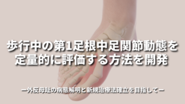 歩行中の第1足根中足関節動態を定量的に評価する方法を開発〜外反母趾の病態解明と新規治療法確立を目指して〜