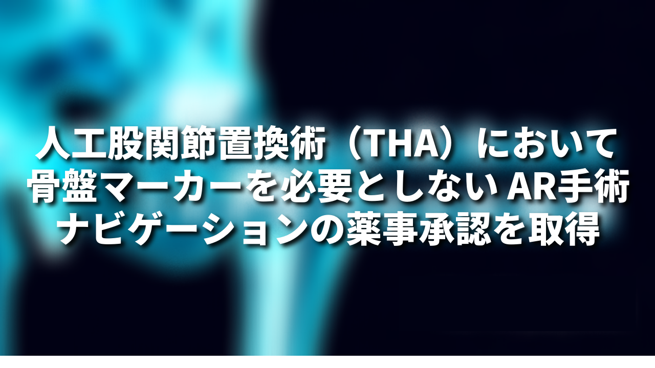 人工股関節置換術（THA）において骨盤マーカーを必要としない AR手術ナビゲーションの薬事承認を取得