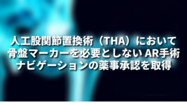 人工股関節置換術（THA）において骨盤マーカーを必要としない AR手術ナビゲーションの薬事承認を取得