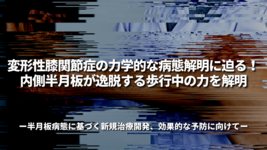 変形性膝関節症の力学的な病態解明に迫る！内側半月板が逸脱する歩行中の力を解明～半月板病態に基づく新規治療開発、効果的な予防に向けて～