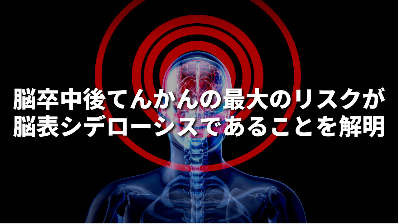 脳卒中後てんかんの最大のリスクが脳表シデローシスであることを解明