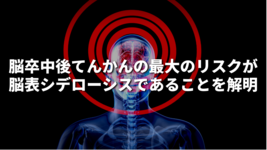 脳卒中後てんかんの最大のリスクが脳表シデローシスであることを解明