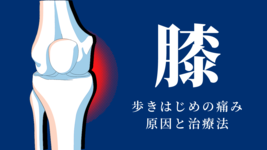 【ニュートラルゾーン】歩き始めの膝の痛みの原因と治療法