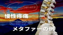 『あなたのヘルニアは富士山です』～慢性疼痛におけるメタファーの例～