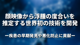 顔映像から浮腫の度合いを推定する世界初の技術を開発 〜疾患の早期発⾒や悪化防⽌に貢献〜