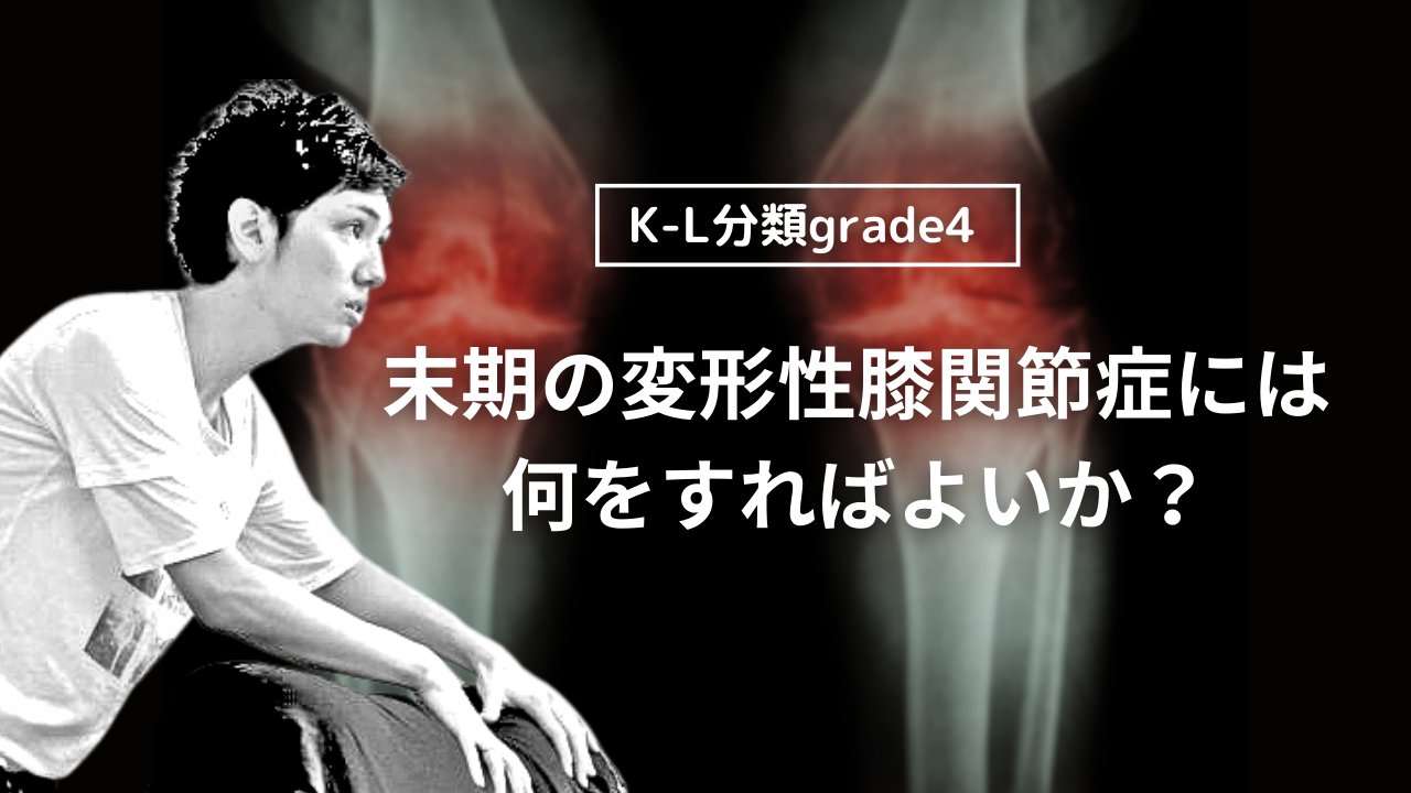 末期の変形性膝関節症には何をすればよいか？