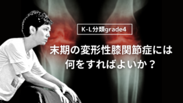 末期の変形性膝関節症には何をすればよいか？