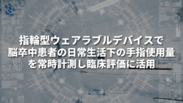 指輪型ウェアラブルデバイスで脳卒中患者の日常生活下の手指使用量を常時計測し、臨床評価に活用