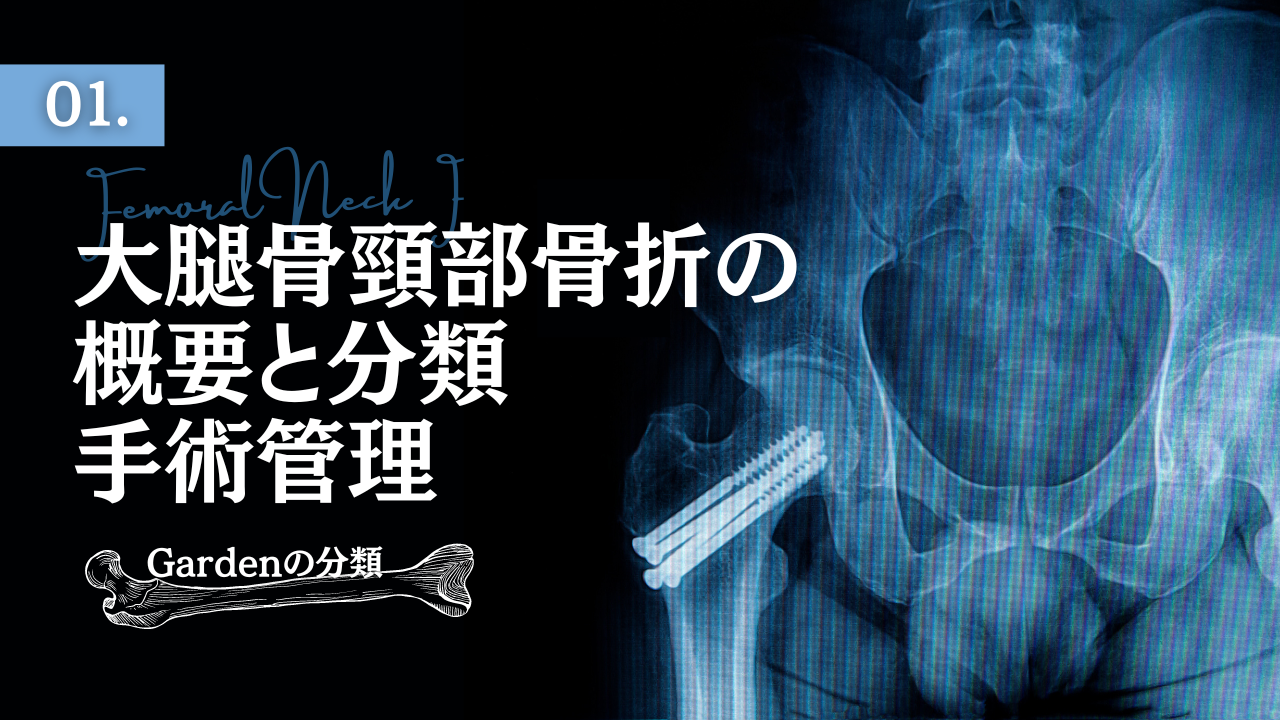 大腿骨頸部骨折の概要と分類