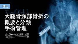 大腿骨頸部骨折の概要と分類