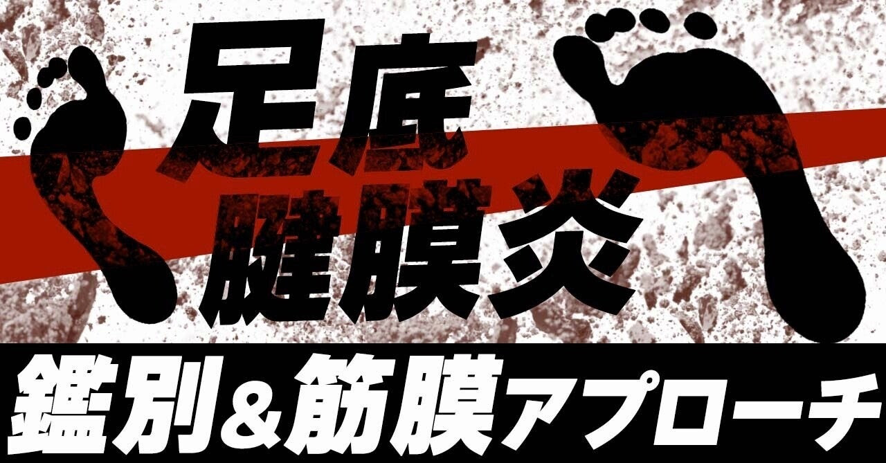 【足底腱膜炎】：鑑別＆筋膜アプローチ（動画付き）
