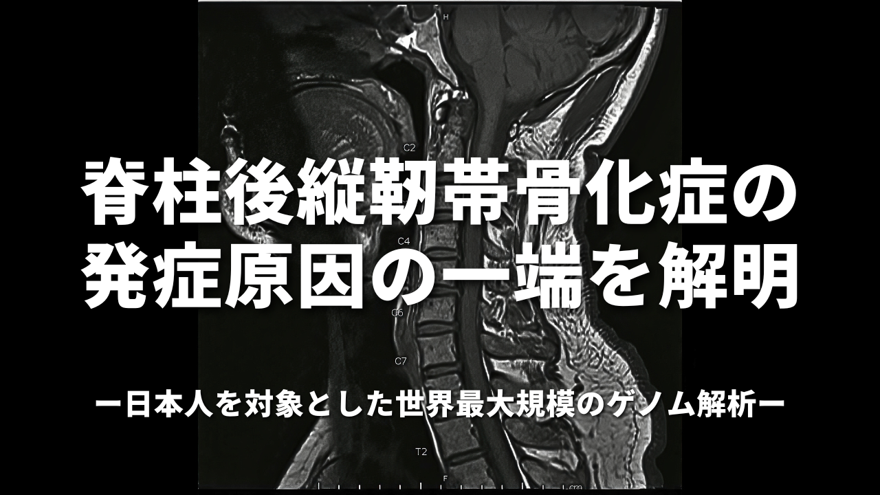 脊柱後縦靭帯骨化症の発症原因の一端を解明－日本人を対象とした世界最大規模のゲノム解析－