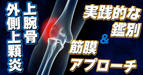 【外側上顆炎】"実践的な鑑別"と"筋膜アプローチ"