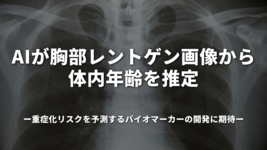 AIが胸部レントゲン画像から体内年齢を推定 重症化リスクを予測するバイオマーカーの開発に期待