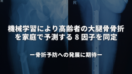 機械学習により高齢者の大腿骨骨折を家庭で予測する 8 因子を同定 ～骨折予防への発展に期待～