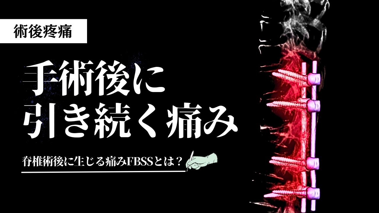 脊椎術後に生じる痛みFBSSとは？
