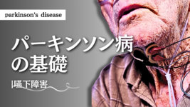 パーキンソン病-嚥下障害-