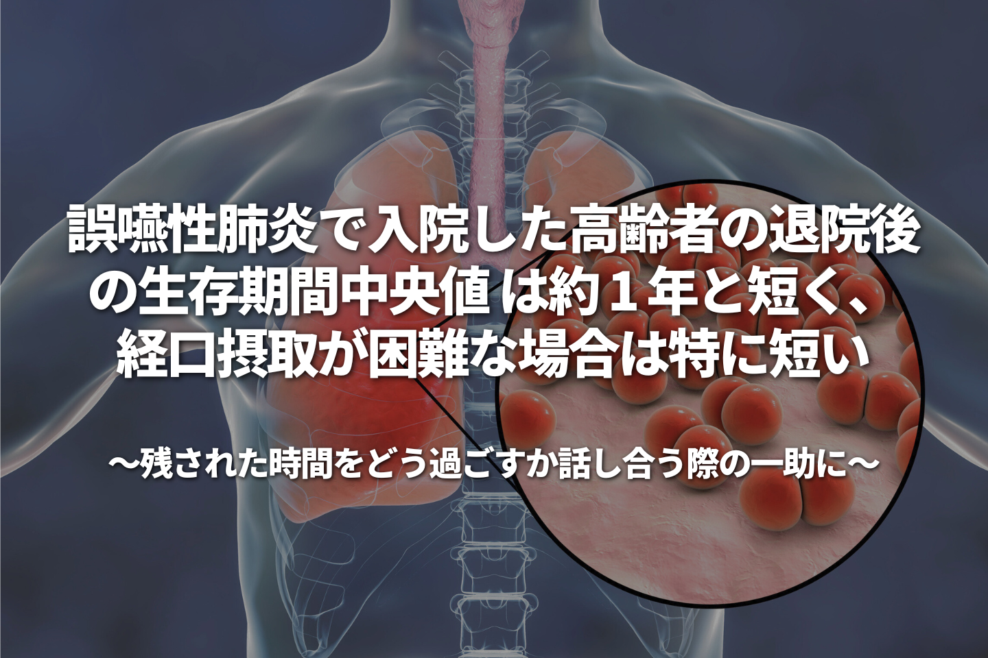 誤嚥性肺炎で入院した高齢者の退院後の生存期間中央値 は約 1 年と短く、経口摂取が困難な場合は特に短い ～残された時間をどう過ごすか話し合う際の一助に～