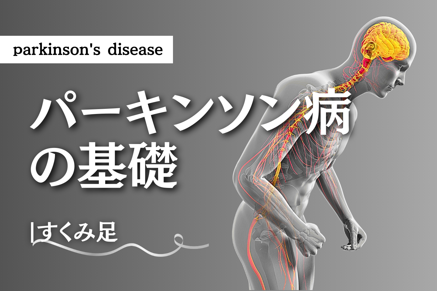 パーキンソン病-すくみ足-