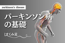 パーキンソン病-すくみ足-