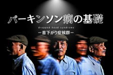 パーキンソン病-首下がり-