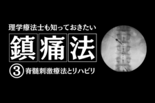 理学療法士も知っておきたい鎮痛法③～脊髄刺激療法とリハビリ～