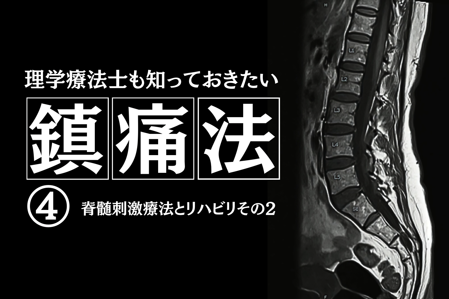 理学療法士も知っておきたい鎮痛法④～脊髄刺激療法とリハビリその２～