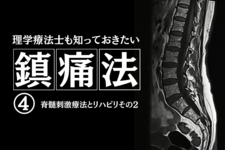 理学療法士も知っておきたい鎮痛法④～脊髄刺激療法とリハビリその２～