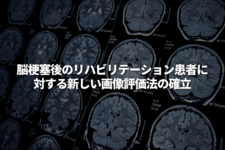 脳梗塞後のリハビリテーション患者に対する新しい画像評価法の確立 （―脳梗塞後の虚血巣における鉄と髄鞘の縦断的変化と神経学的予後との関連―）
