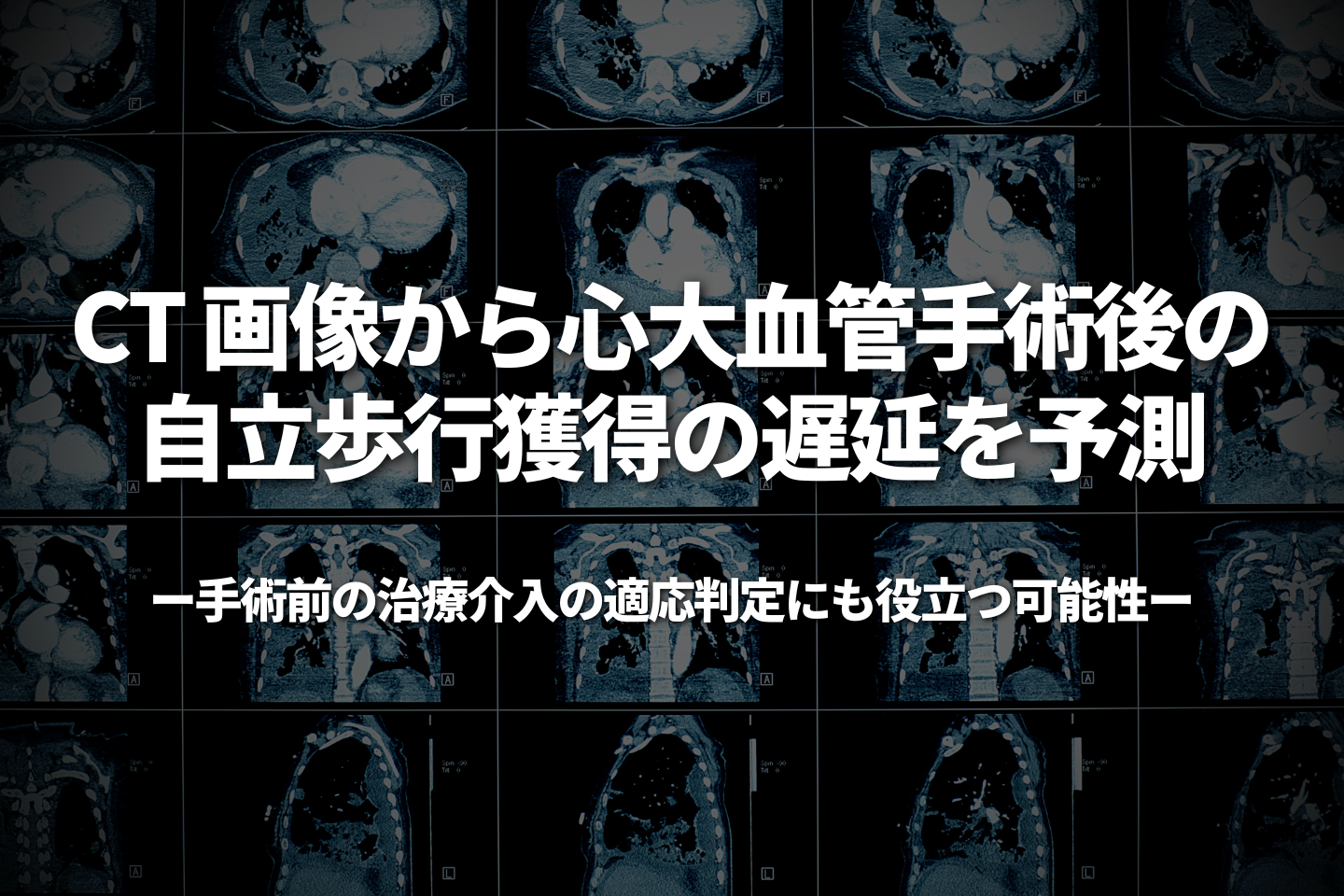 CT 画像から心大血管手術後の自立歩行獲得の遅延を予測 -手術前の治療介入の適応判定にも役立つ可能性-