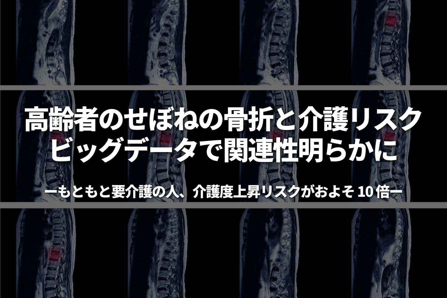 高齢者のせぼねの骨折と介護リスク ビッグデータで関連性明らかに 〜 もともと要介護の人、介護度上昇リスクがおよそ 10 倍 〜