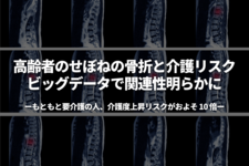 高齢者のせぼねの骨折と介護リスク ビッグデータで関連性明らかに 〜 もともと要介護の人、介護度上昇リスクがおよそ 10 倍 〜