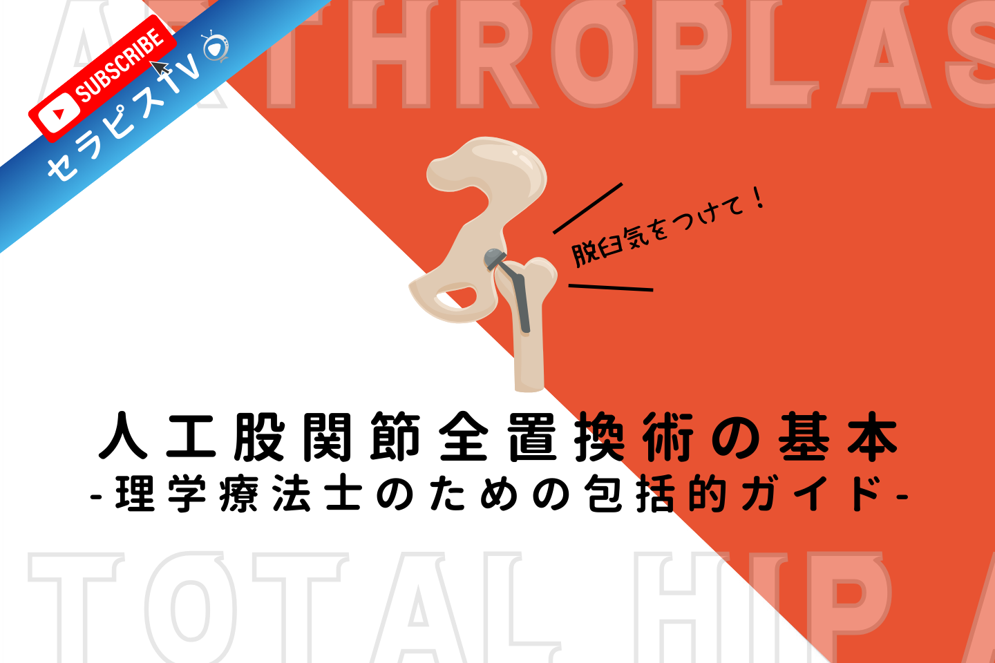 人工股関節全置換術（THA）の基本：理学療法士のための包括的ガイド