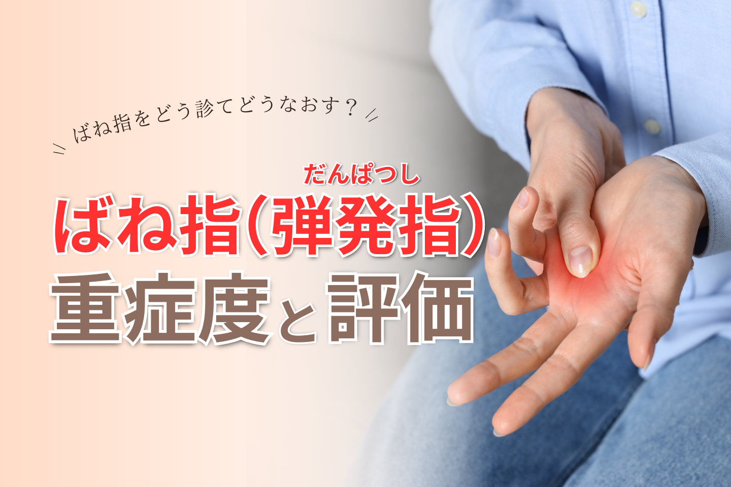 【弾発指】ばね指の重症度と評価