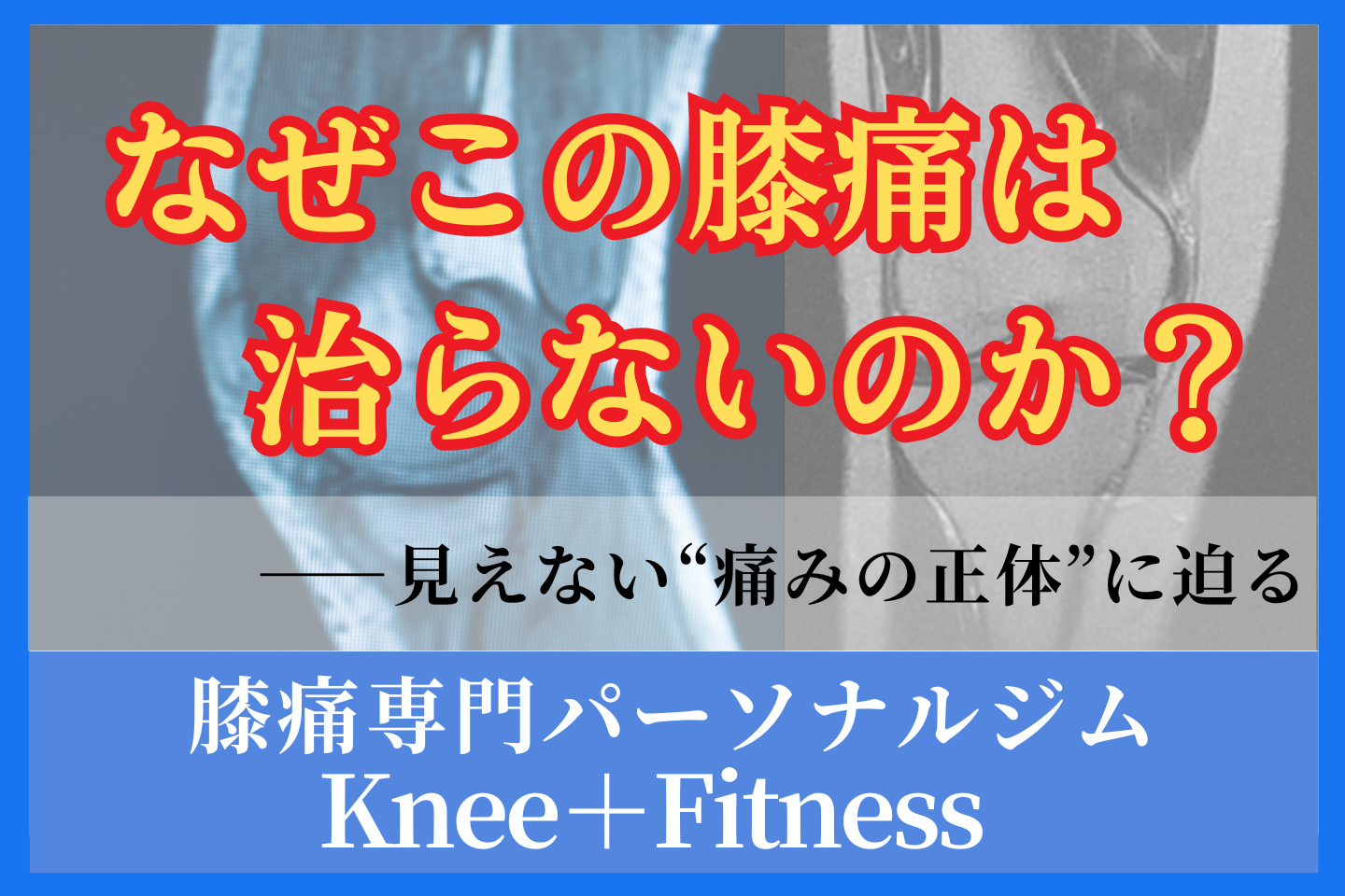 なぜこの膝痛は治らないのか？―見えない“痛みの正体”に迫る