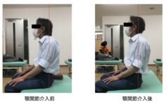 頚部や肩・肩甲帯の疼痛や機能障害は顎関節の影響かも？ 〜理学療法士が解説する「隠れ顎関節症」と全身の関係〜