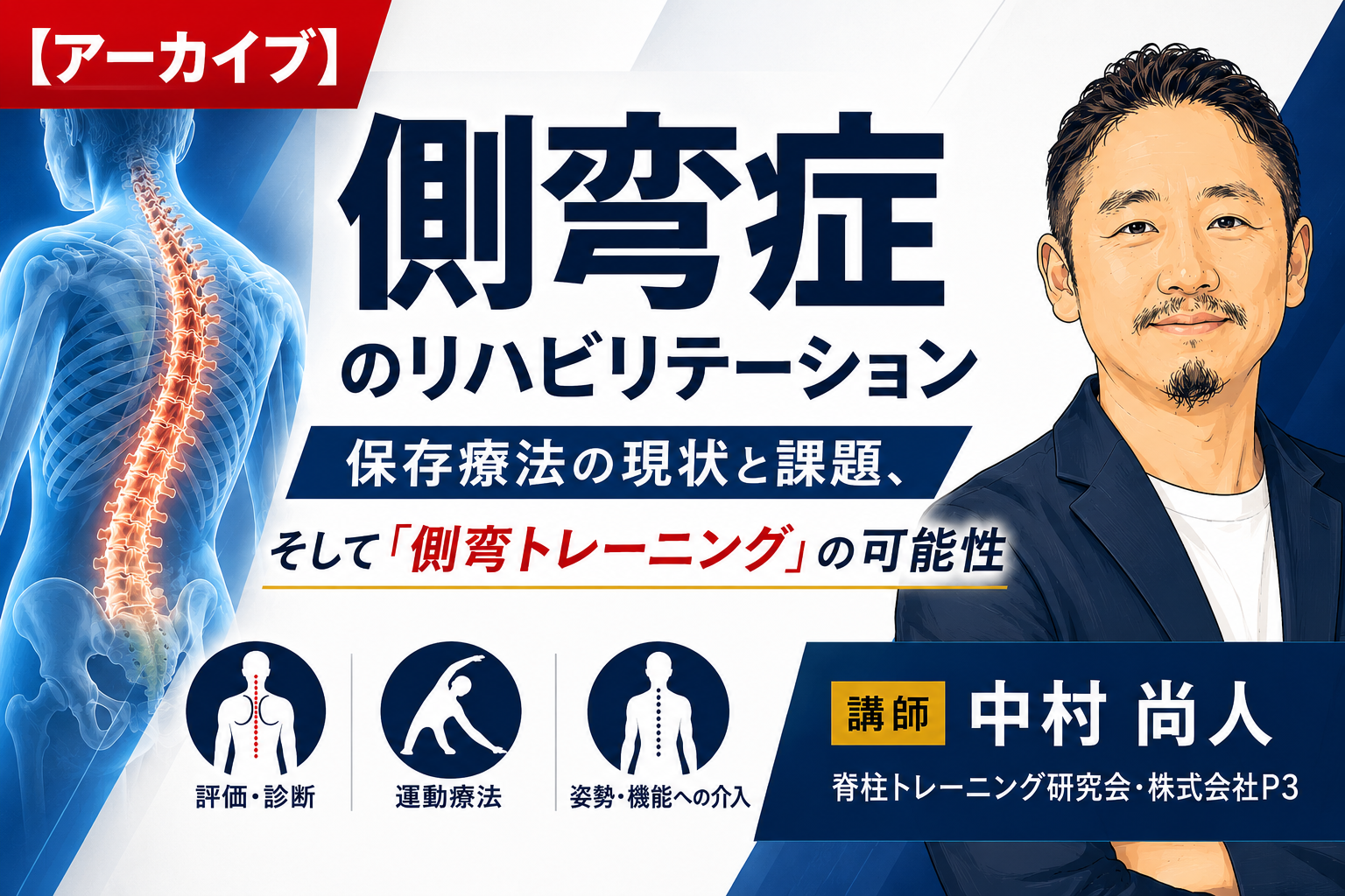 【アーカイブ】側弯症のリハビリテーション〜保存療法の現状と課題、そして「側弯トレーニング」の可能性〜