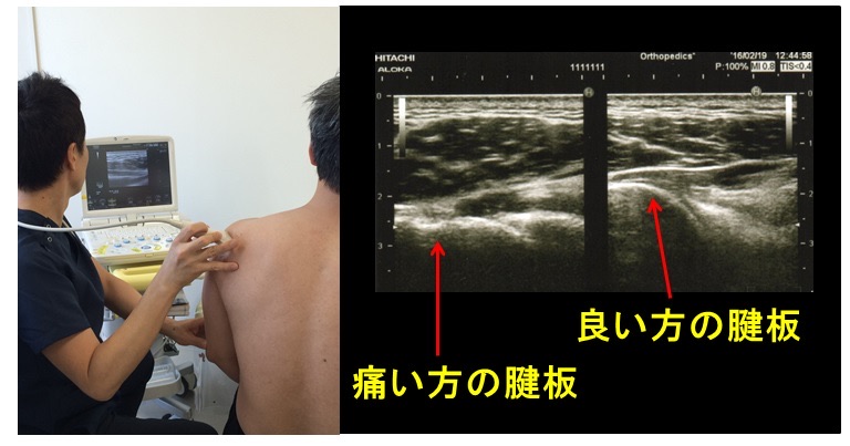 明日の臨床に活かす！リハビリに必要な運動器画像の捉え方