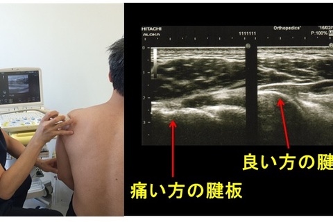 明日の臨床に活かす！リハビリに必要な運動器画像の捉え方