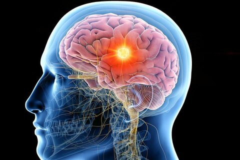 【オンラインセミナー】 新人から学べるPT・OT・STのための基礎から学ぶ脳画像の診かた