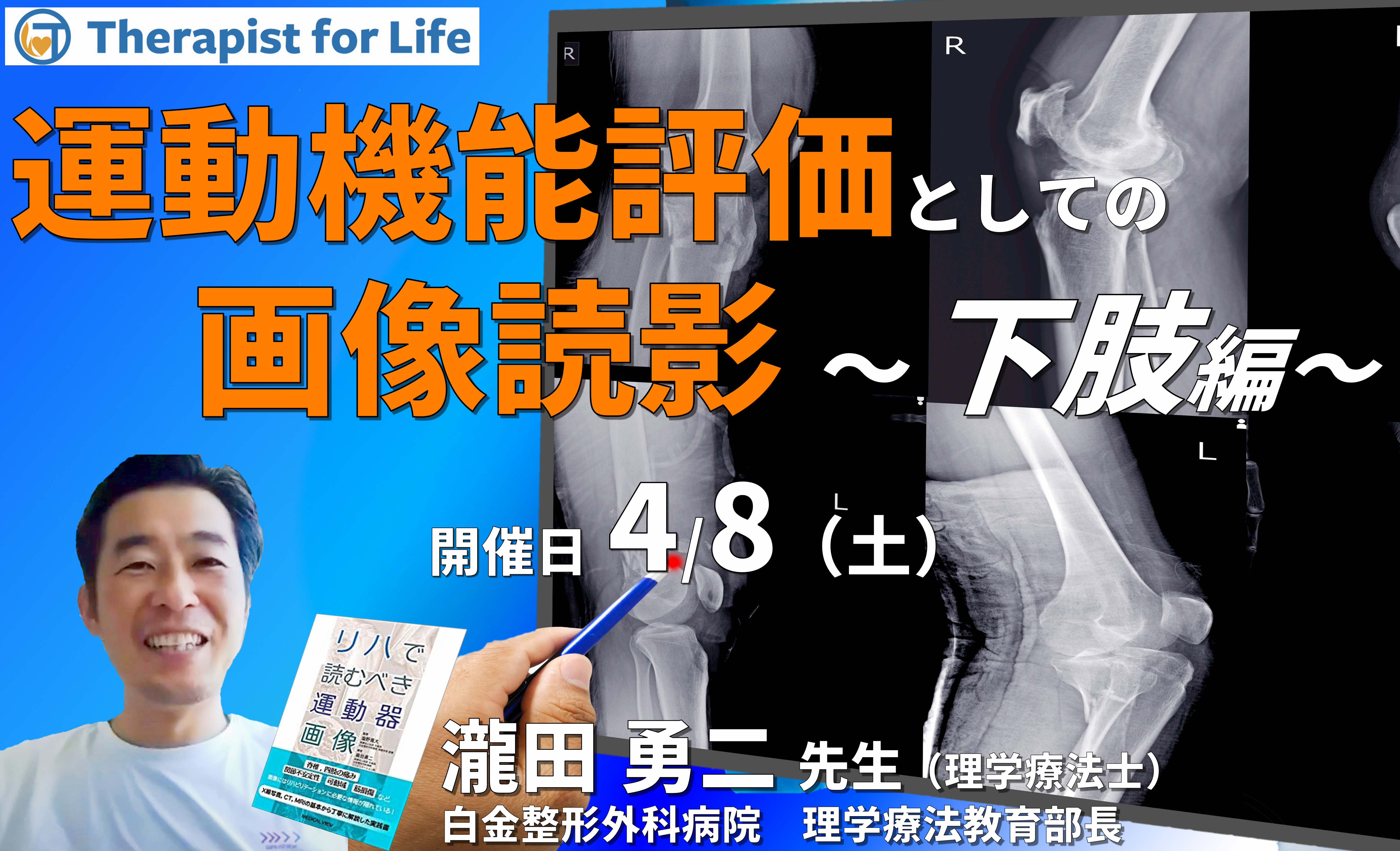 セラピストのための運動機能評価としての画像の読影(下肢編)~評価精度の向上、治療方針の明確化 講師:瀧田勇二先生