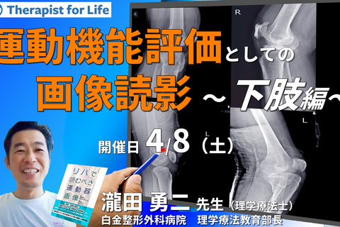 セラピストのための運動機能評価としての画像の読影（下肢編）～評価精度の向上、治療方針の明確化　講師：瀧田勇二先生