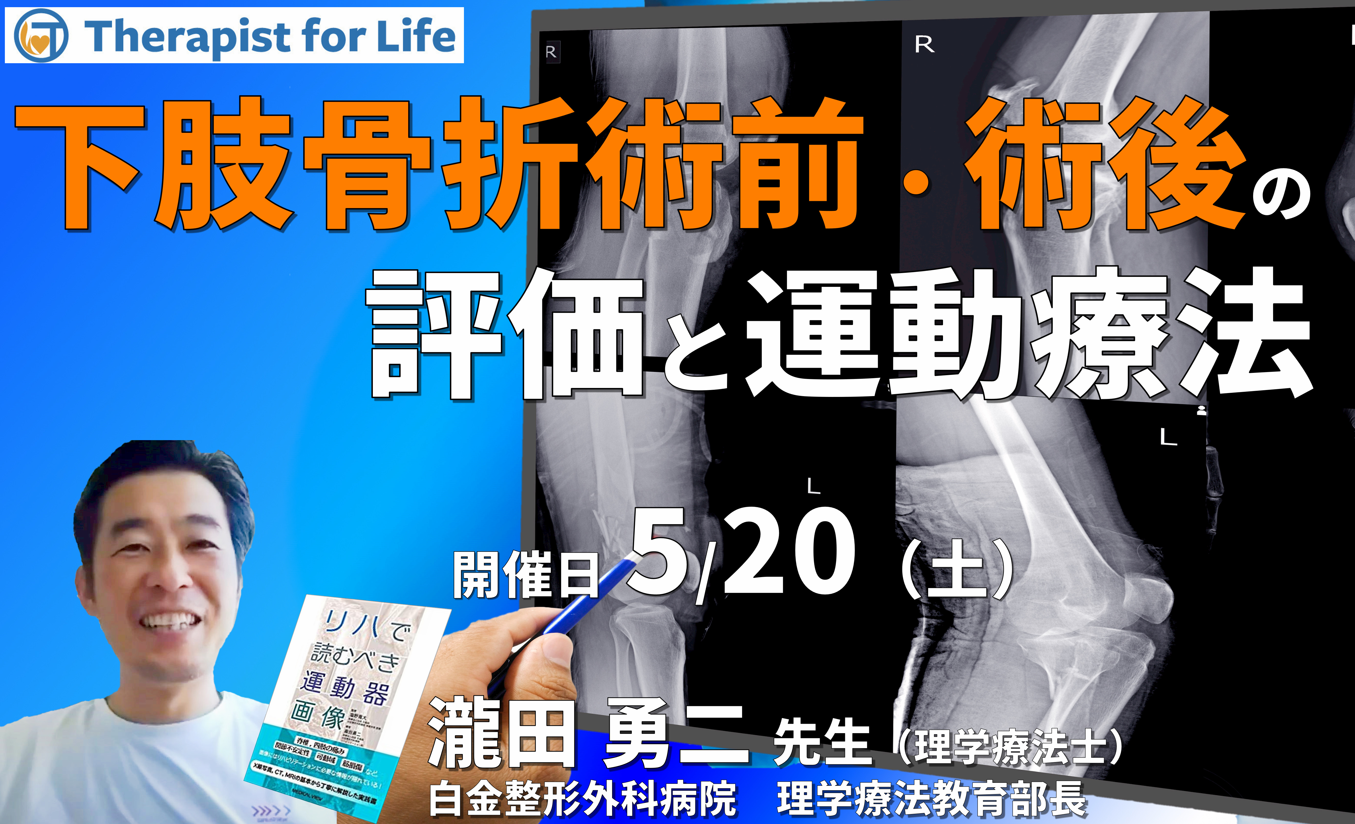 臨床成績が上がる、下肢骨折・術前術後の評価と運動療法~リスク管理から運動療法まで自信を持って行うために~ 講師:瀧田勇二先生