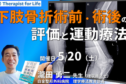 臨床成績が上がる、下肢骨折・術前術後の評価と運動療法~リスク管理から運動療法まで自信を持って行うために～　講師：瀧田勇二先生